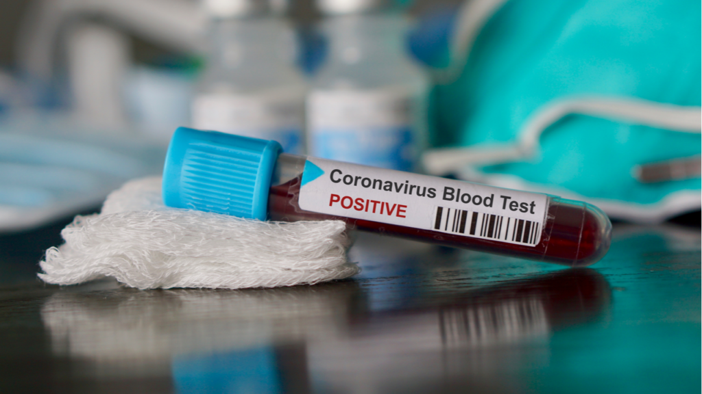 В Венгрии у казахстанки обнаружили коронавирус