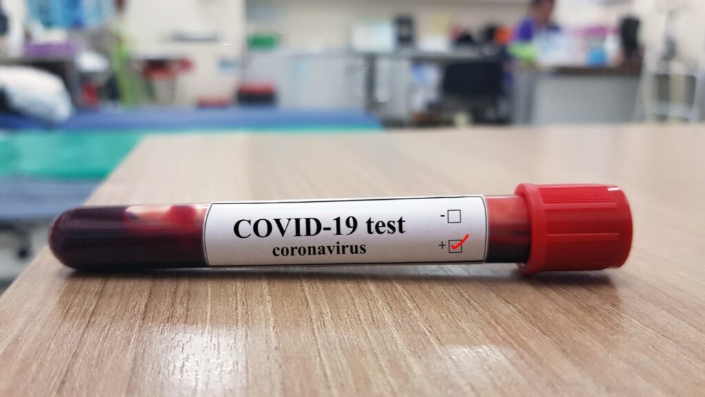 В Пекине началось массовое тестирование на коронавирус
