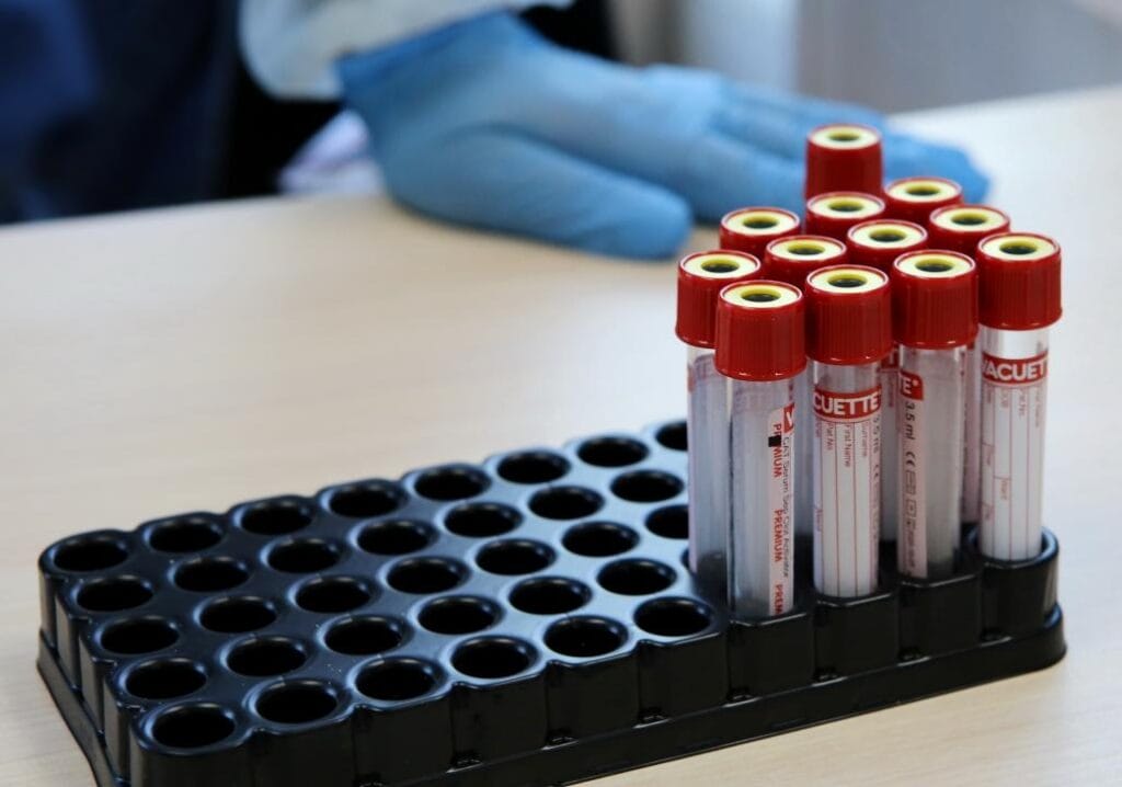 Фото: Аскар Ахметллин