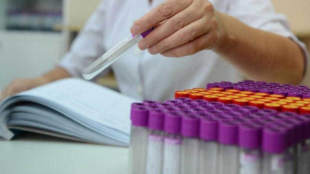 Әлемде коронавирус жұқтырғандар саны 18 миллионнан асты