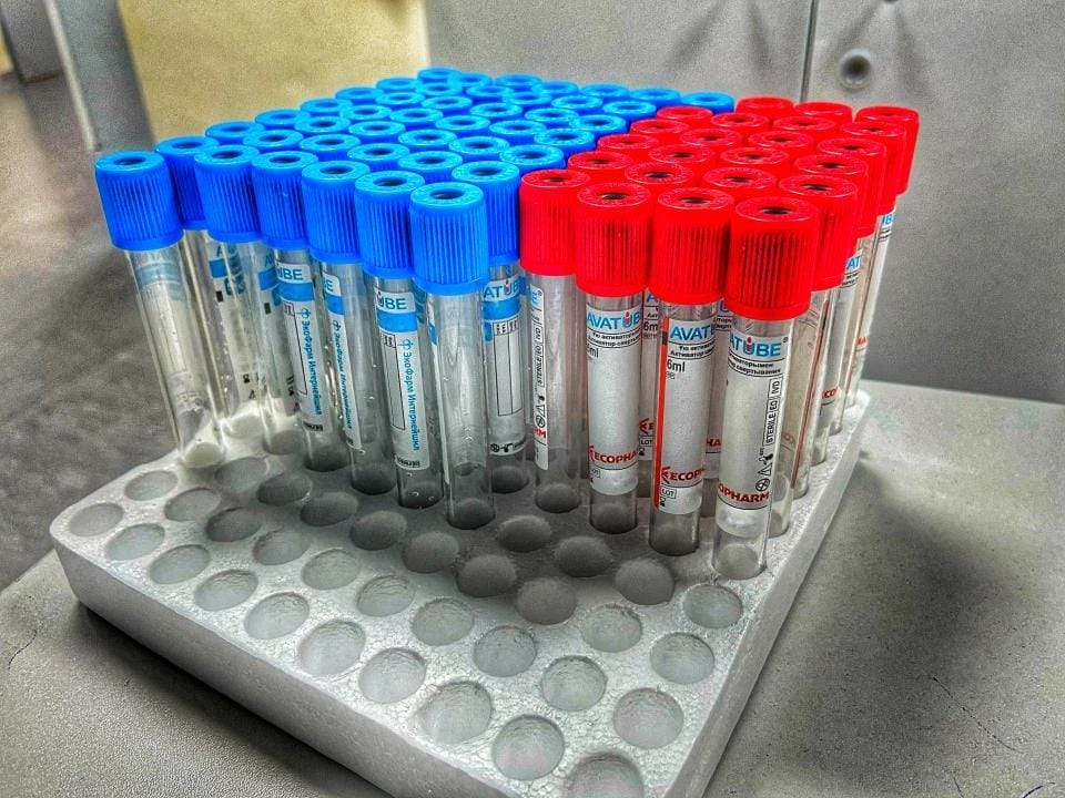 Қазақстанда тағы 403 адам коронавирус жұқтырған