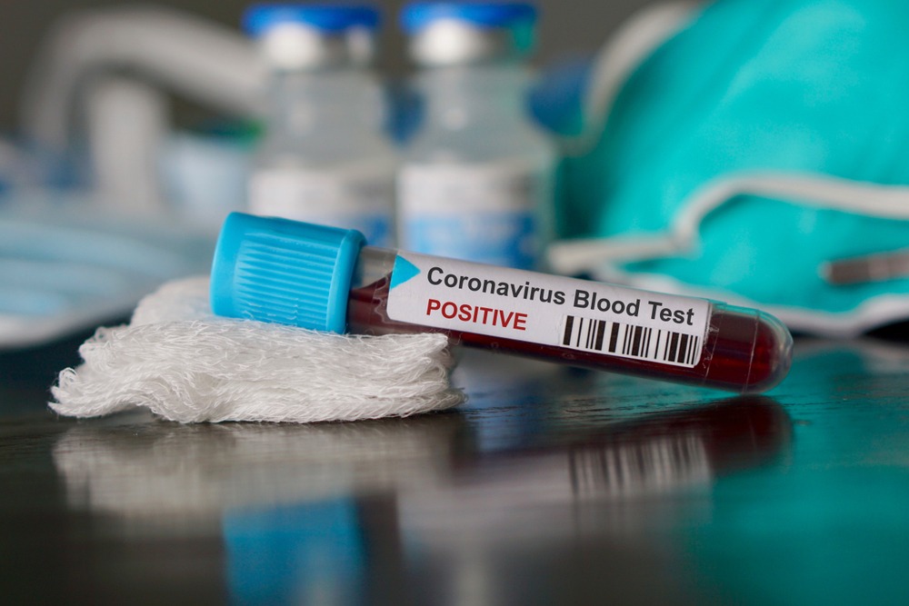 В Узбекистане выявлен первый случай заражения коронавирусом