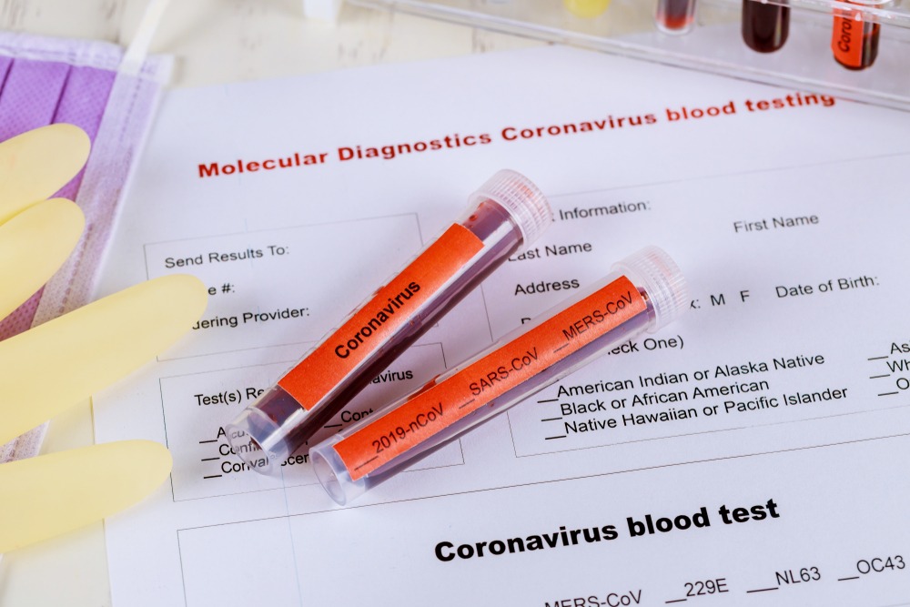 Фото: Shutterstock