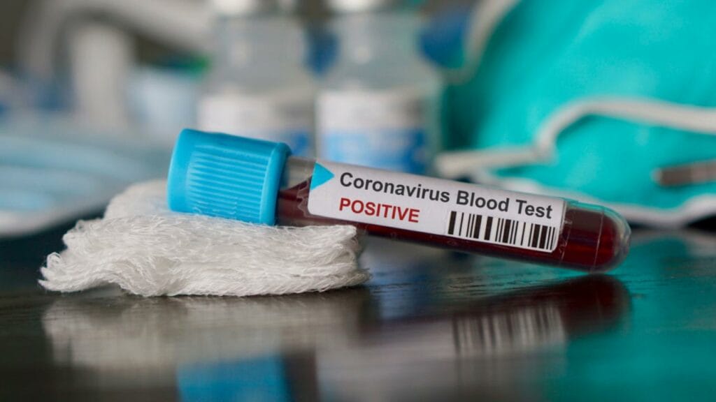 Фото: Shutterstock