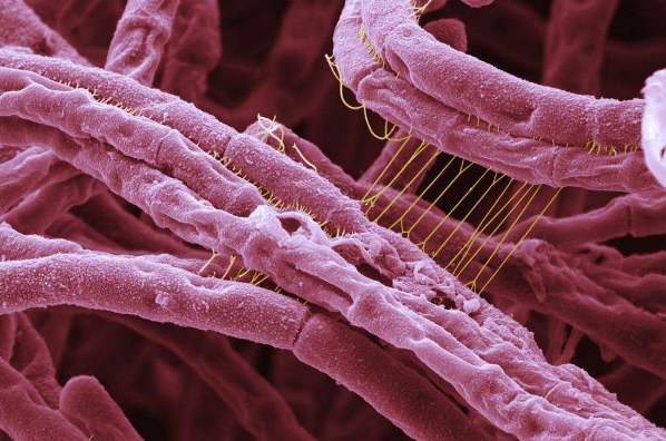 Два казахстанца скончались, предположительно, от сибирской язвы