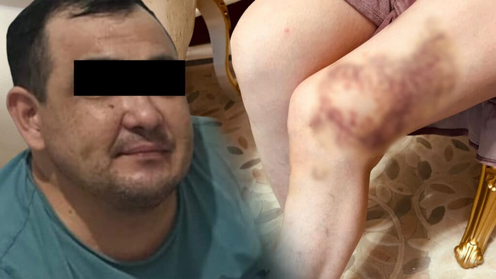 Жительница Актау пожаловалась на побои со стороны мужа и угрозу убийства