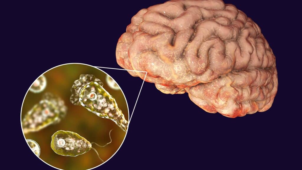 Үндістанда миды жейтін қауіпті амеба құрбаны көбейді