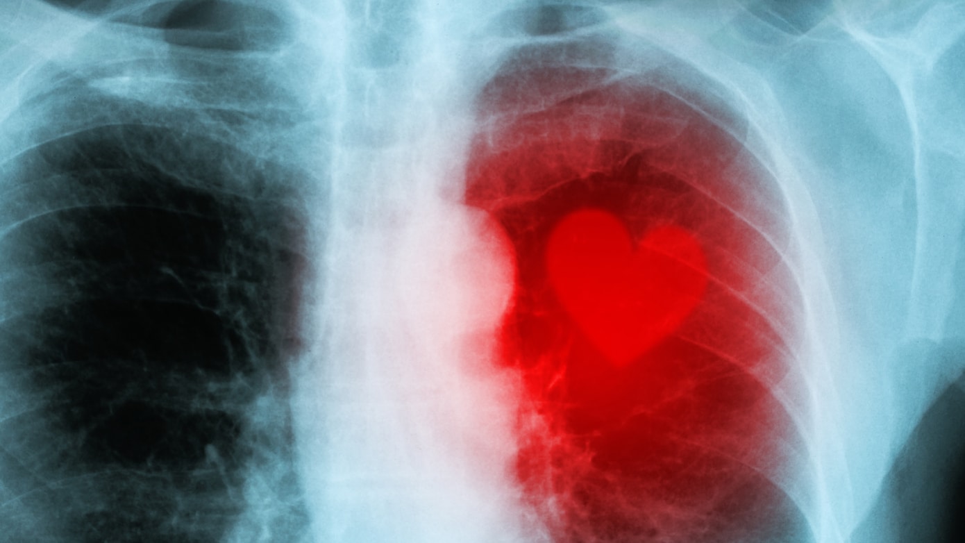 Mama Son Porn қараңыз