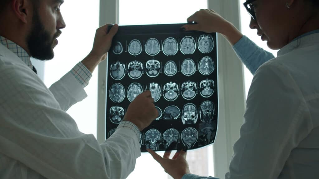 Ученые Кембриджа выяснили, что мозг остается на «подростковом» уровне до 30 лет