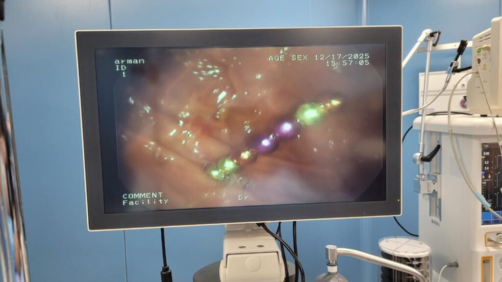 баланың ішінен магнит шықты